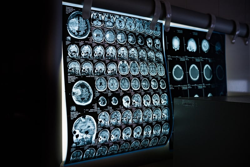 Body scan meditations